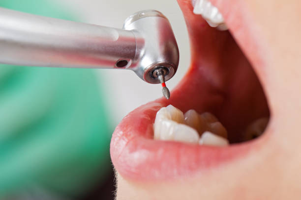Best Emergency Treatment for Oral Infections in Spring Valley Village, TX